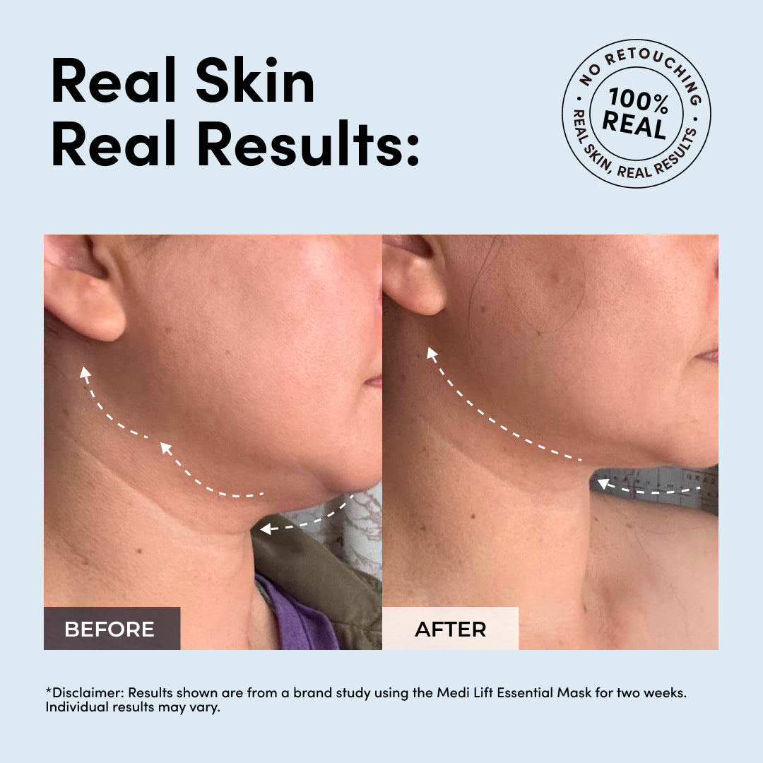 The Multi-Masking Bundle