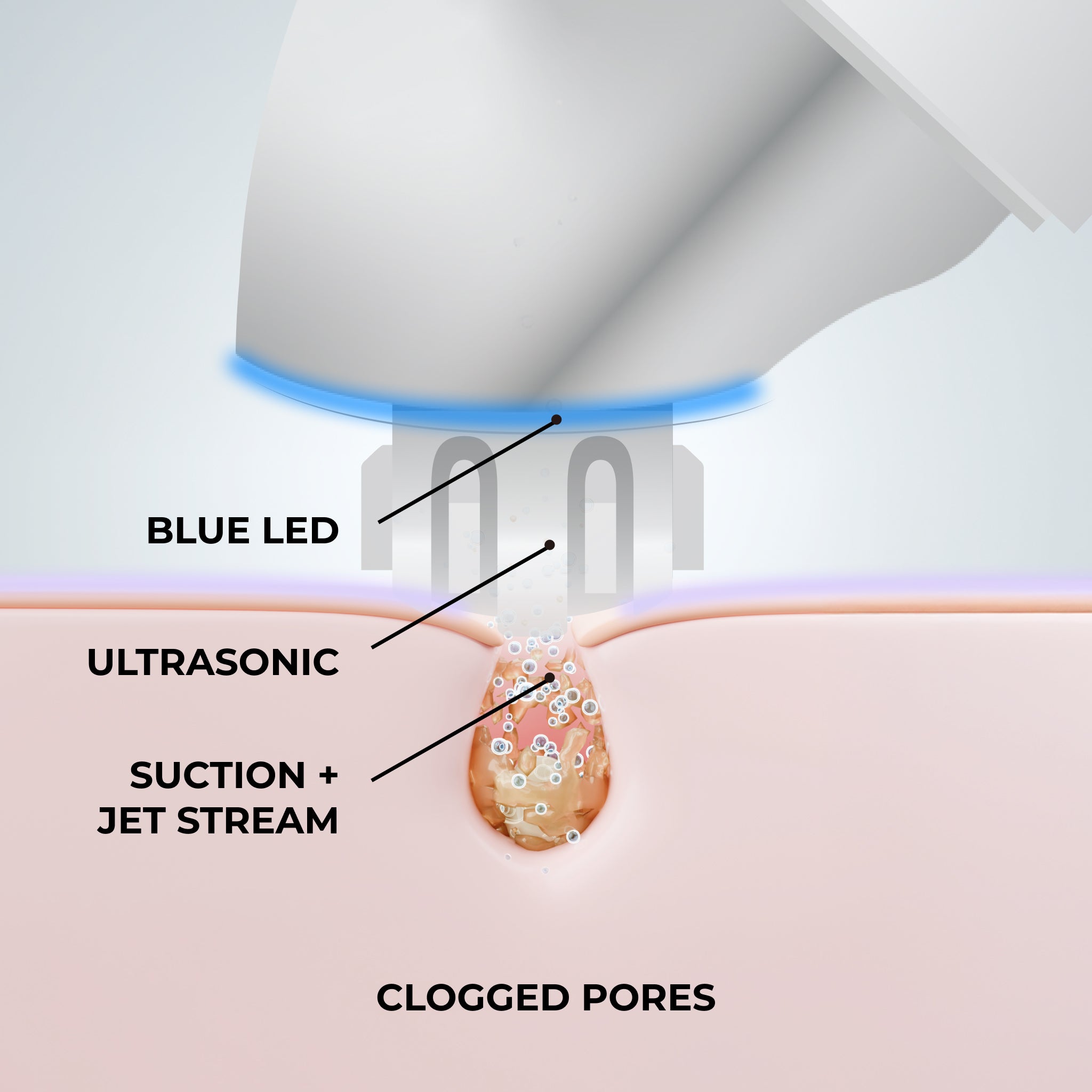 POREFICIENT™ Advanced Deep Pore Cleansing Device with Suction, Ultrasonic & Blue LED