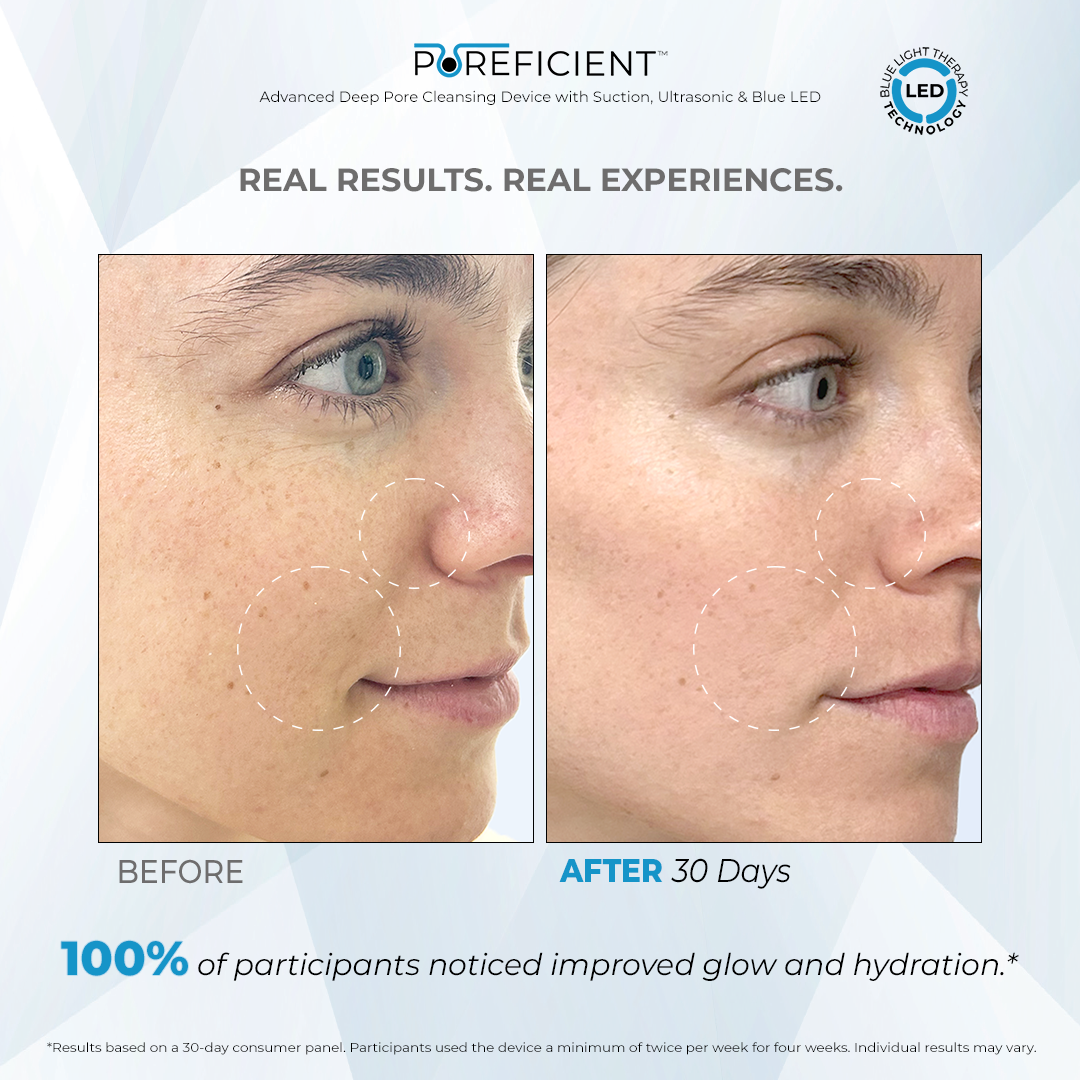 POREFICIENT™ Exfoliating Serum