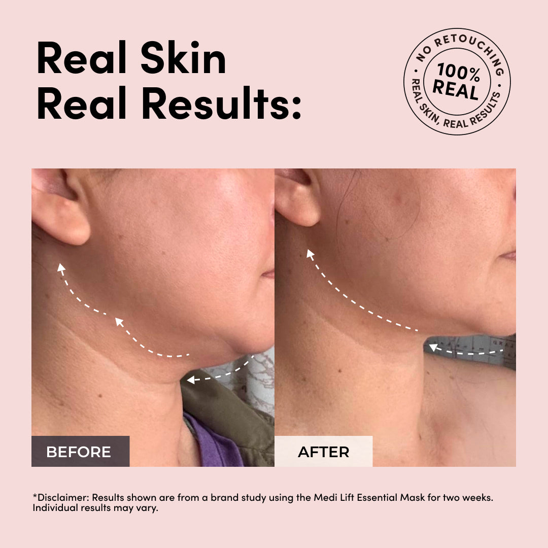 Luxe Lift Mask Set (White Pulse)