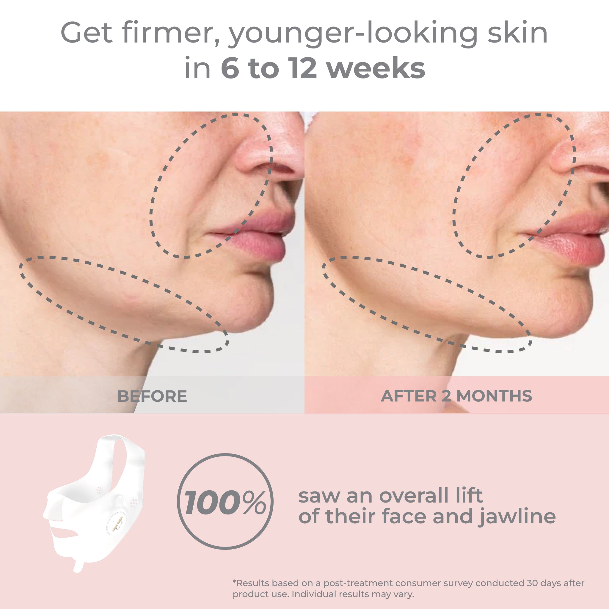 Luxe Lift Mask Set (White Pulse)